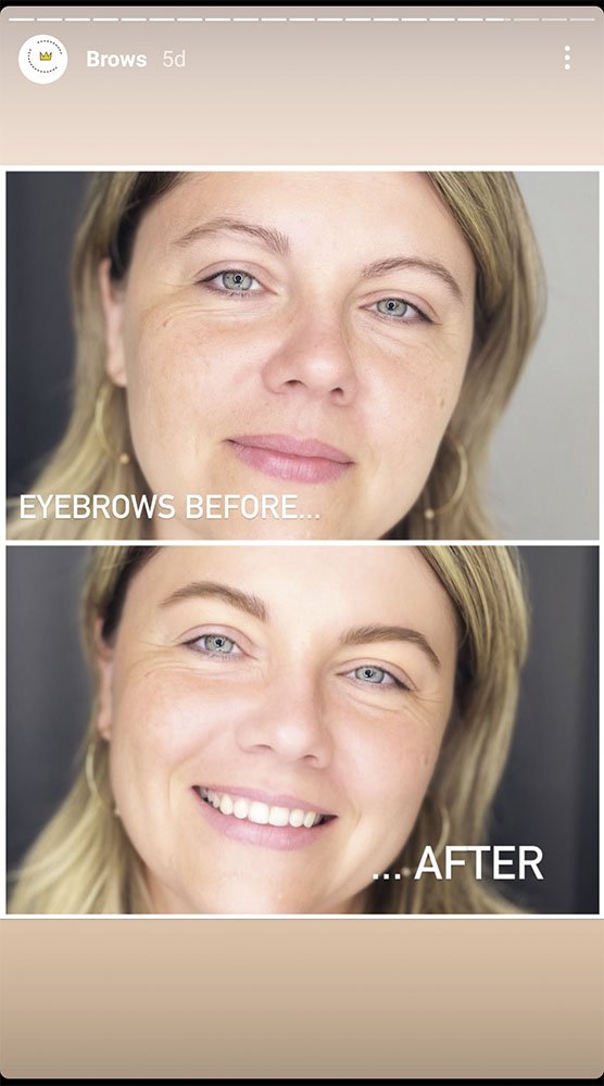 Brows correction Amsterdam